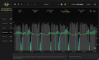 NoiseWorks VoiceAssist
